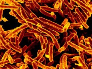 Mycobacterium_tuberculosis_MEB_(1) مرض السل