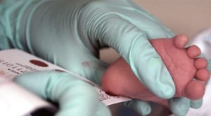 Microbiology Techs diagnos samples تحليل TSH
