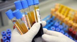mch-blood-test_cf93fbe40541784c تحليل MCH