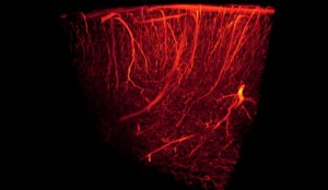 Blood_vessels-3D_rendering اللوكيميا