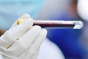 gloved-hand-holding-lh-blood-test-sample تحليل هرمون LH